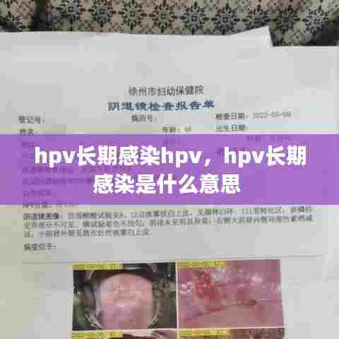 hpv长期感染hpv,hpv长期感染是什么意思