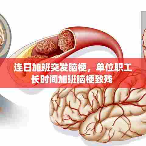 连日加班突发脑梗，单位职工长时间加班脑梗致残 